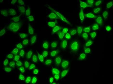 RANGAP1 Antibody