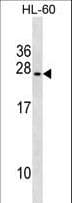 IHC-plus™ Polyclonal Rabbit anti-Human UBE2S / E2 EPF Antibody (aa183-210, IHC, WB)