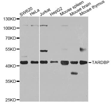 TDP-43 / TARDBP Antibody
