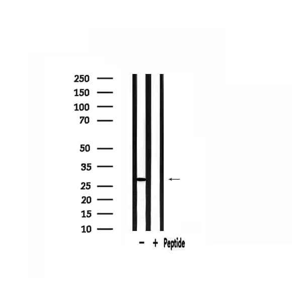 RPS3 / Ribosomal Protein S3 Antibody