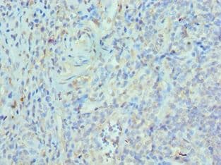 ETV6 / TEL Antibody (aa1-300)