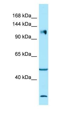 ITGA2 / CD49b Antibody (aa899-948)