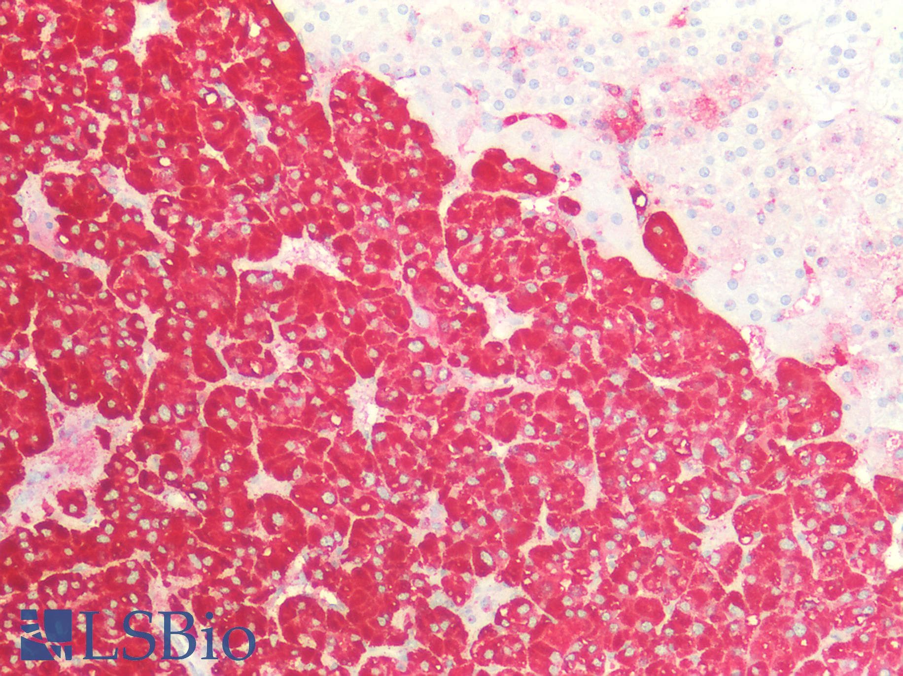 PathPlus™ CHGA / Chromogranin A Antibody