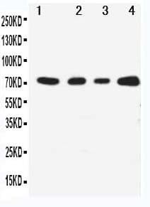 MAP3K3 / MEKK3 Antibody (aa11-25)