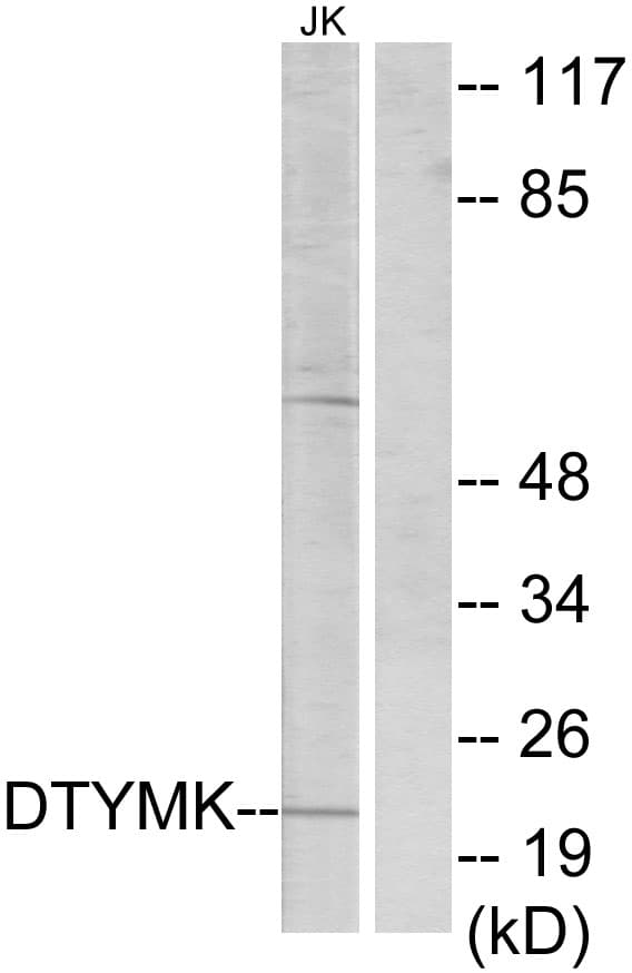 Polyclonal Rabbit anti-Human Thymidylate Kinase Antibody (aa1-50, IHC, WB)