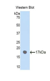 PLXNB1 / Plexin-B1 Antibody (aa47-173)