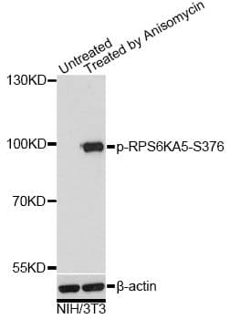 Polyclonal Rabbit anti-Human RPS6KA5 / MSK1 Antibody (phospho-Ser376, WB)