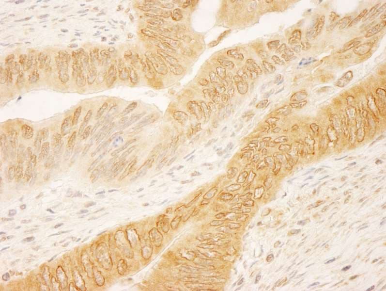 Polyclonal Rabbit anti-Human RANGAP1 Antibody (aa400-450, IHC)