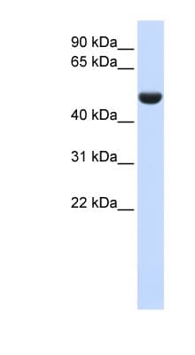 CD36 Antibody (aa36-85)