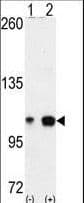 Polyclonal Rabbit anti-Human EPHA4 / EPH Receptor A4 Antibody (aa875-904, IHC, WB)