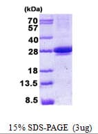 Human MIS12 Protein (Recombinant His)