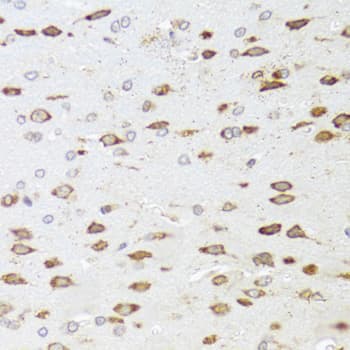 ARHGAP5 / RhoGAP5 Antibody
