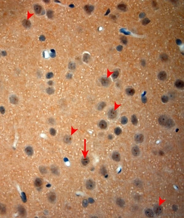 NGF Antibody (aa130-180)