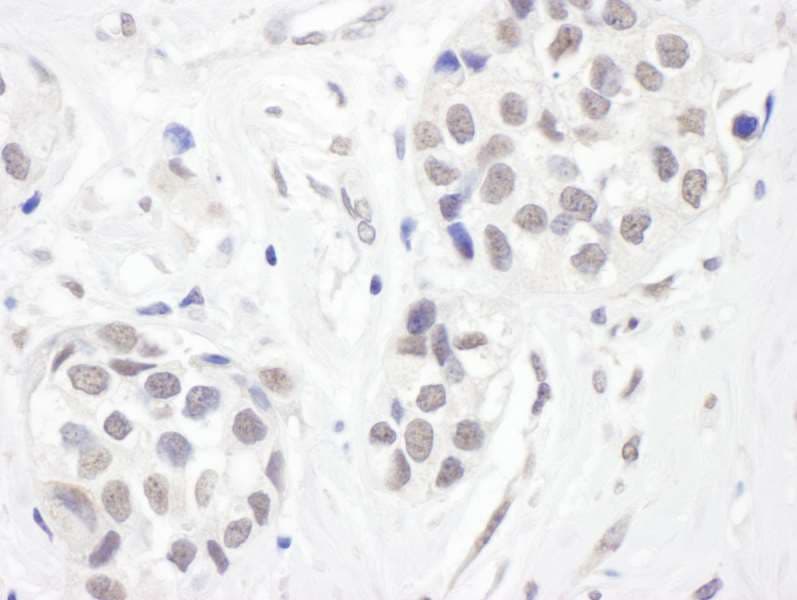 CHD8 Antibody (aa2252-2302)