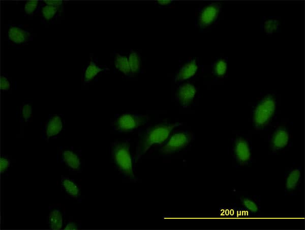 RNMT / HCM Antibody (clone 3H3-1D12)