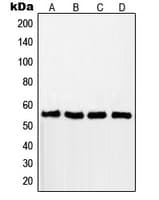 RAD18 Antibody (Internal)