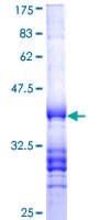 Human PTGER4 / EP4 Protein (Recombinant GST, N-terminus)