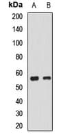 Polyclonal Rabbit anti-Human EGLN2 / PHD1 Antibody (WB)