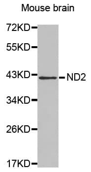 IHC-plus™ Polyclonal Rabbit anti-Mouse MT-ND2 Antibody (IHC, WB)