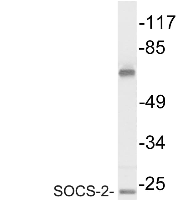 SOCS2 Antibody (aa18-67)