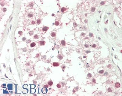 IHC-plus™ Polyclonal Rabbit anti-Human NCL / Nucleolin Antibody (C-Terminus, IHC, WB)