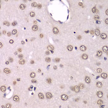HNRPM / HNRNPM Antibody