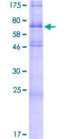 Human TMEFF2 Protein (Recombinant GST)