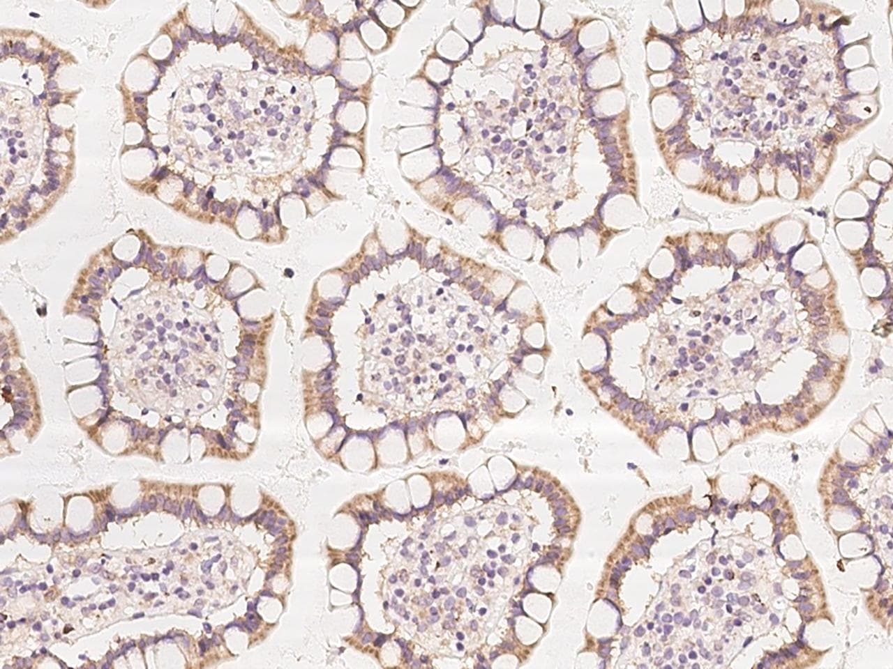ZNF354C Antibody