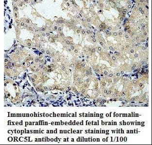 ORC5 Antibody (aa65-354)