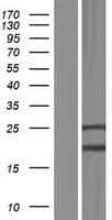 FRA9F Protein (Over-Expression Lysate Myc-DDK (Flag))