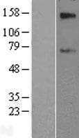 SLC39A12 / ZIP12 Protein (Over-Expression Lysate Myc-DDK (Flag))