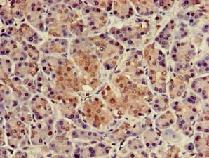Polyclonal Rabbit anti-Human NUPR1 Antibody (IHC, IF)