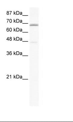 CACNB2 Antibody (aa523-572)