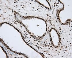 APP / Beta Amyloid Precursor Antibody (clone OTI5F1)