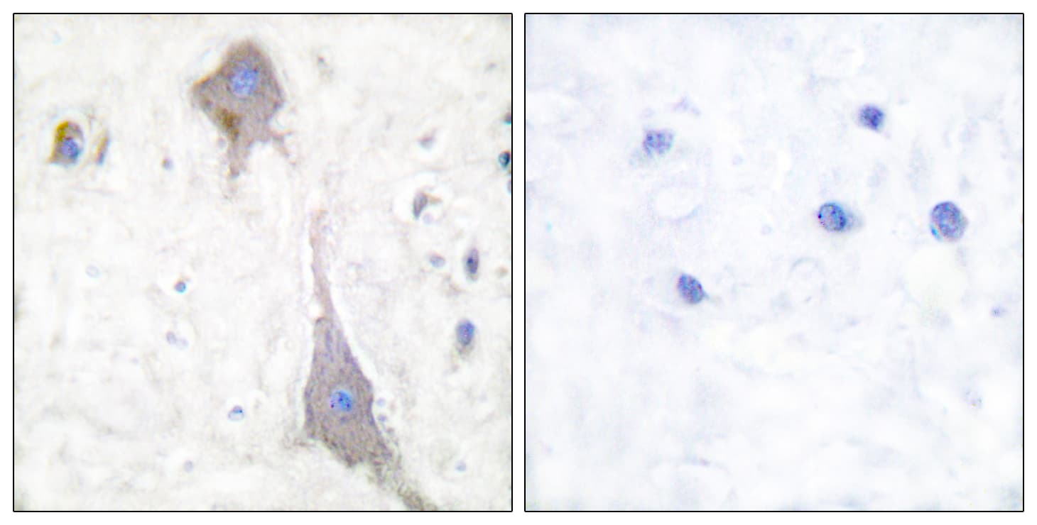 GRM7 / MGLUR7 Antibody (aa866-915)
