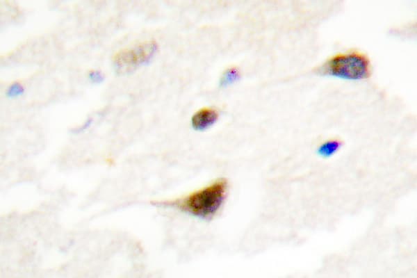 TRF1 / TERF1 Antibody (Leu215)