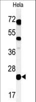 C16orf54 Antibody (aa170-198)