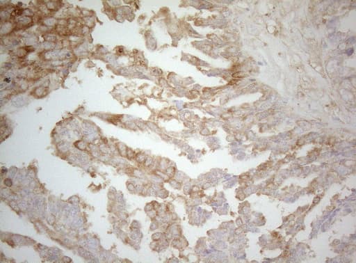 TWF1 / PTK9 Antibody (aa140-384, clone OTI5C12)