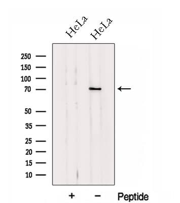 HP1BP3 Antibody
