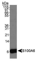 S100A6 / Calcyclin Antibody