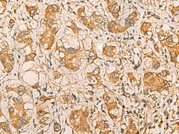 Polyclonal Rabbit anti-Human MRPL9 Antibody (IHC)