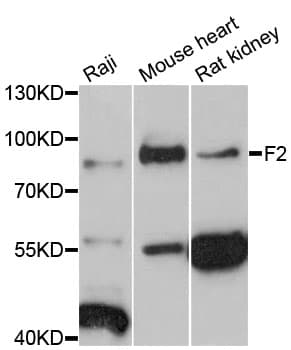 F2 / Prothrombin / Thrombin Antibody