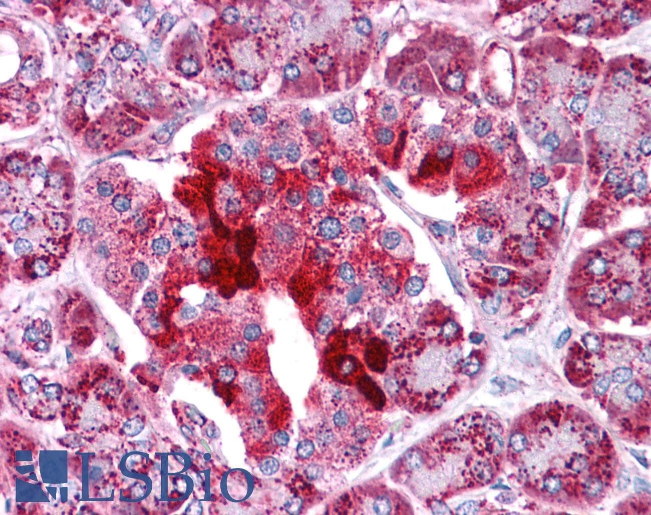 Polyclonal Rabbit anti-Human HADHB Antibody (aa351-400, IHC, WB)