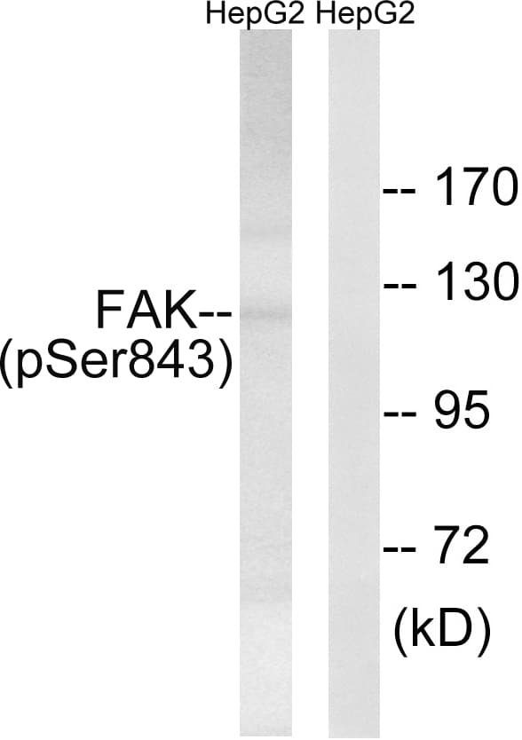 FAK / Focal Adhesion Kinase Antibody (phospho-Ser843)