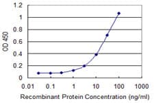EVC / DWF-1 Antibody (clone 3C4)