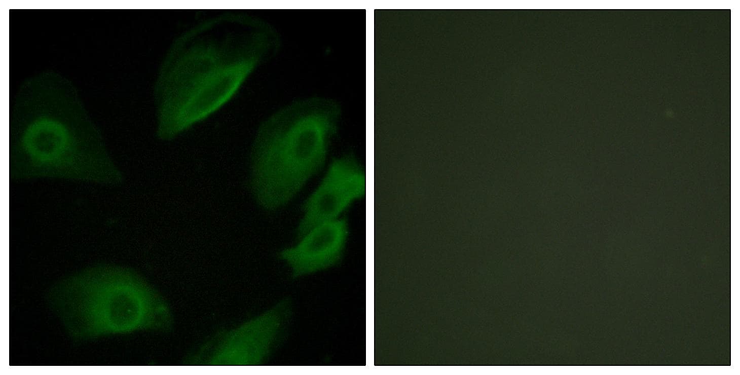 Polyclonal Rabbit anti-Human p56lck / LCK Antibody (p505, IF, WB)