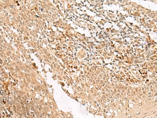 HUS1 Antibody