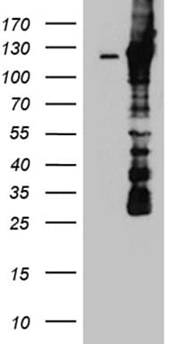 DBN1 / Drebrin Antibody (aa2-240, clone OTI4B3)