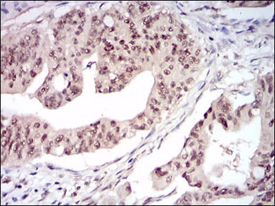 DNMT / DNMT1 Antibody (aa1448-1594, clone 7C11A2)