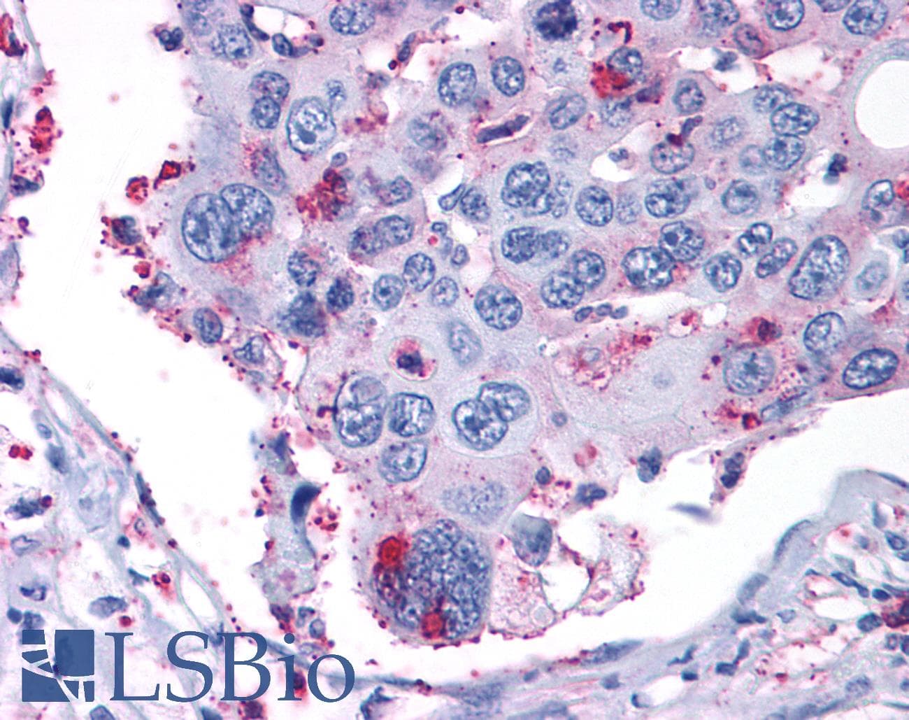 PathPlus™ Polyclonal Rabbit anti-Human MAPK3 / ERK1 Antibody (Internal, IHC)